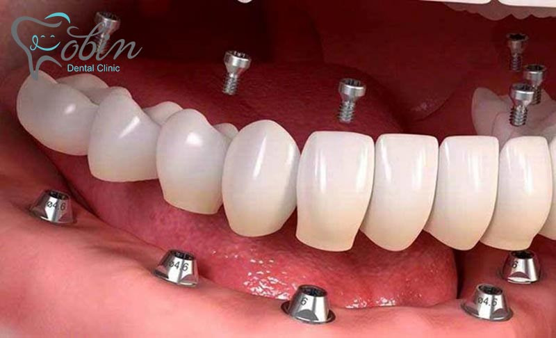 دندانپزشک با تجربه و ماهر 